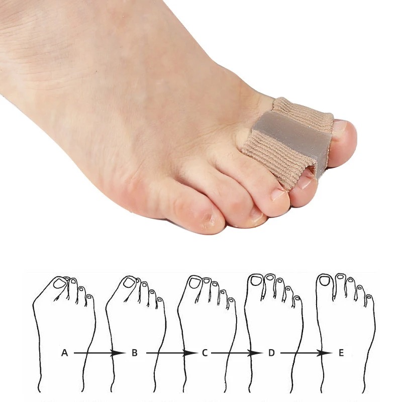 4PC Silicone Toe Separator Fin - đánh giá và giá Yoga Toe Separator