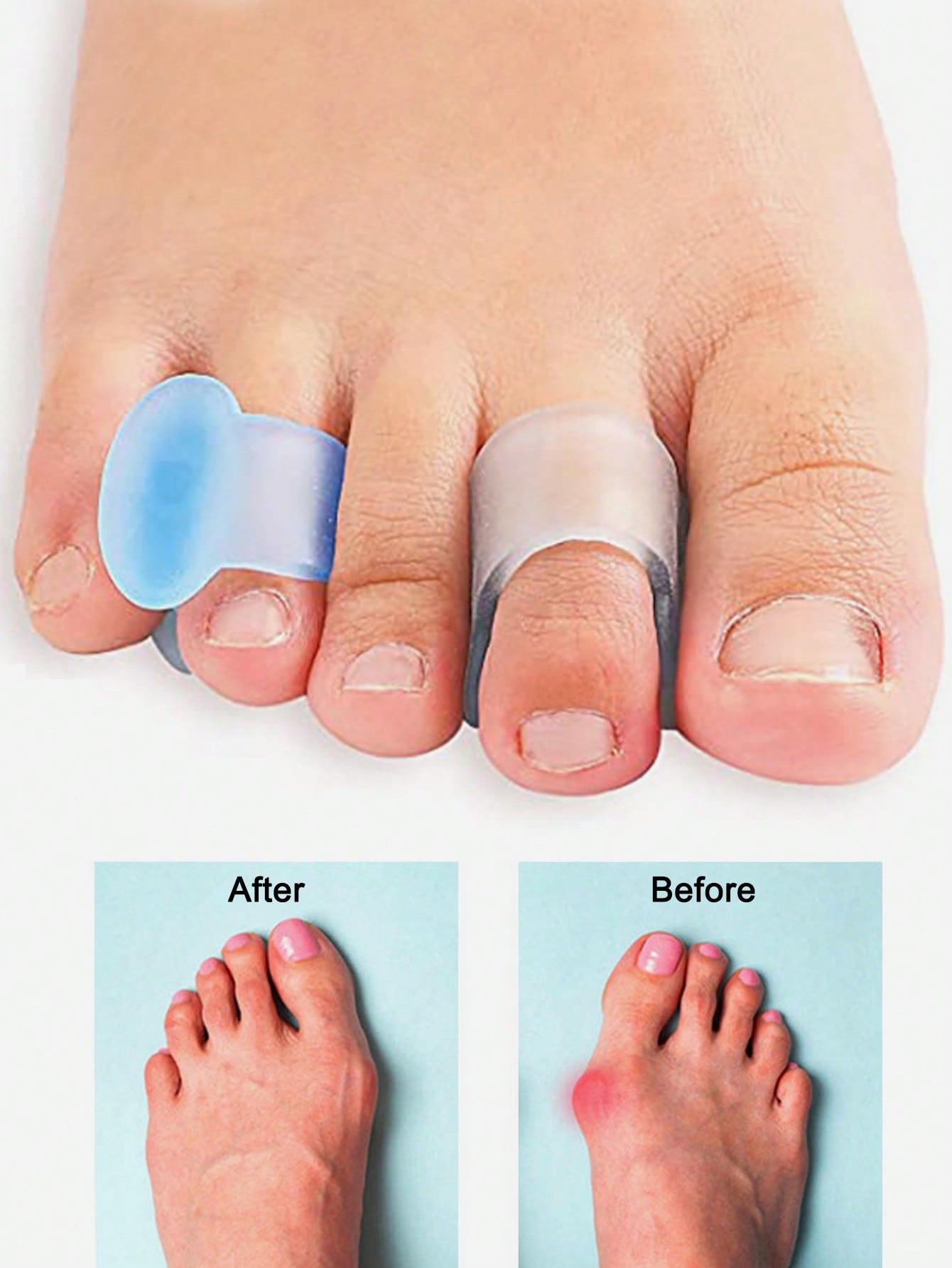 Gel Toe Separator, 4pcs Silico - đánh giá và giá Yoga Toe Separator